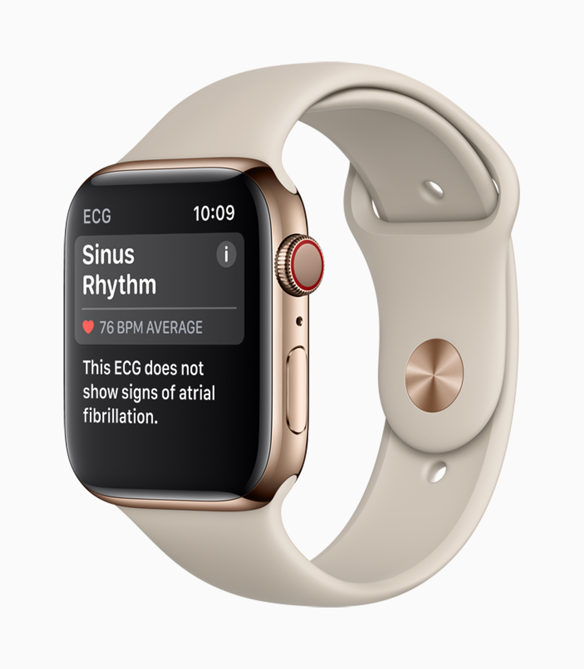 Apple Watch Series 4, Sinus Rhythm